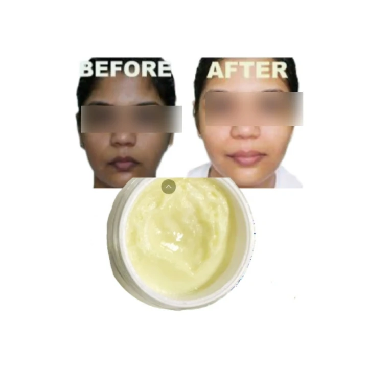 Whitening Products Kojic Acid Cream Whitening Face in America Face Cream Wholesale