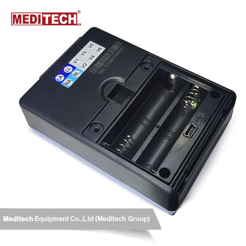 CE and ISO Approved Stress Test ECG System with Bluetooth Connectivity for Hospital Diagnostics