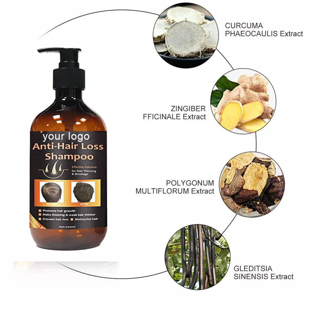 Private Label Organic Ginger Hair Fall Fast Grow Anti Hair Loss Products for Men Hair Growth Regrowth Shampoo