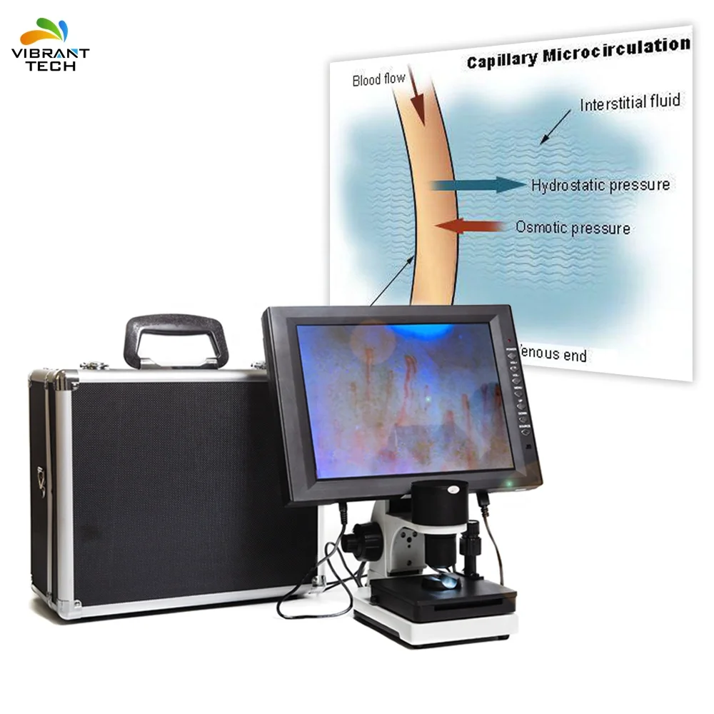  Big Video Displayer микроциркуляция крови тест здоровья