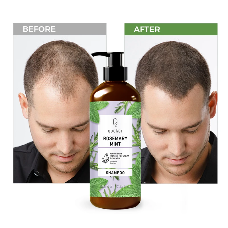 Qquaker Best Price Prevent Hair Loss Rosemary Mint Shampoo And Conditioner Smooth Private Label Hair Care Set For African Hair