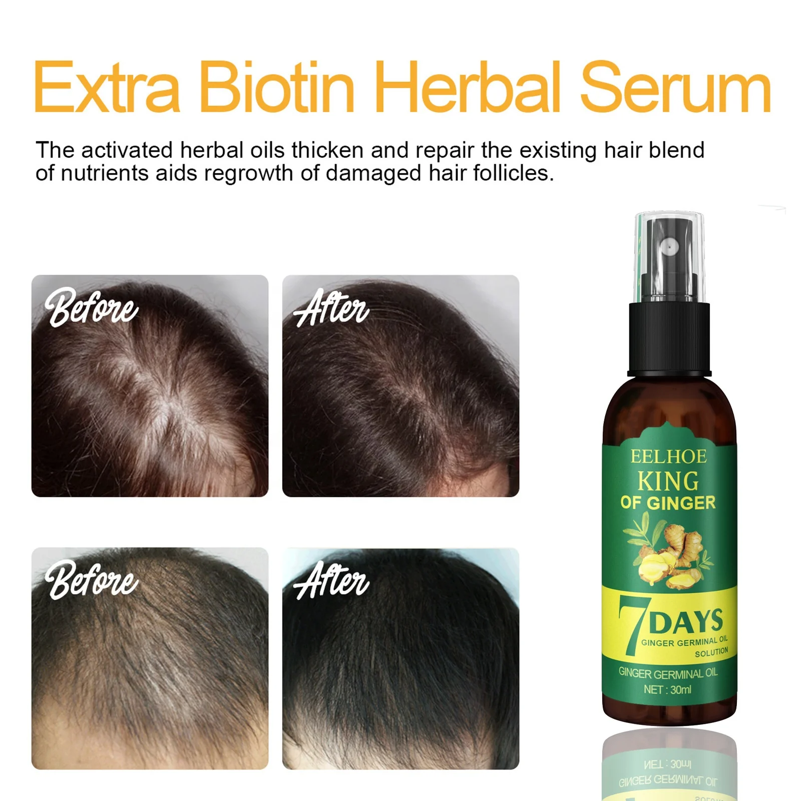 2024 China hot sale 30ml regrow 7 day ginger germinal hair growth serum ginger essential oil hair growth serum spray