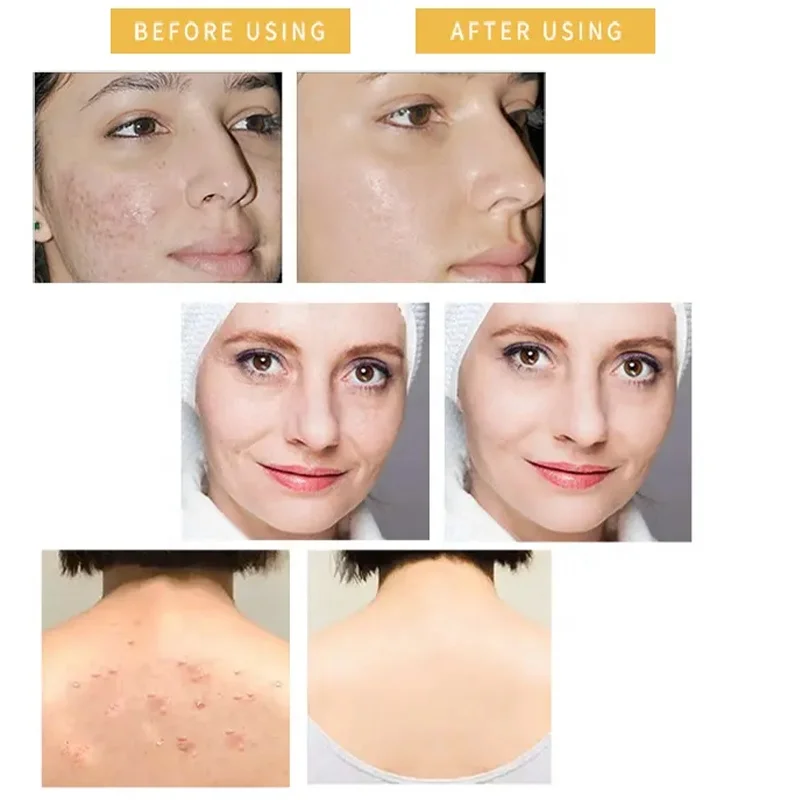 Wholesale 100g Handmade Bleaching Soap Antibacterial Skin Whitening Face Body Bath Bar Whitening Skin Soap