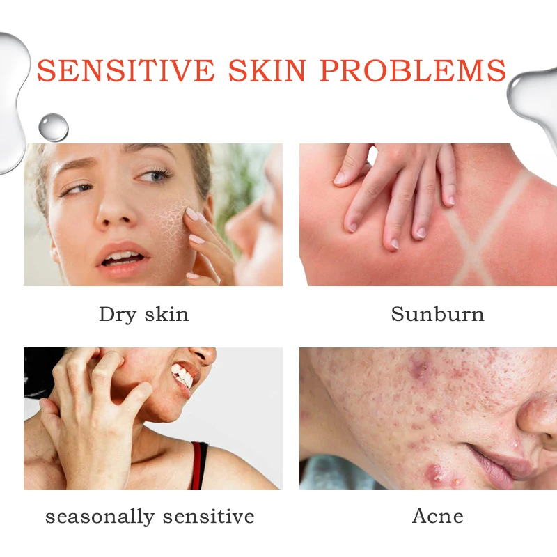 Private Label Organic Thermal Spring Water Spray Water Face Toner Lighten Anti-Aging Skincare Sooth Hydrate Facial Toner Spray