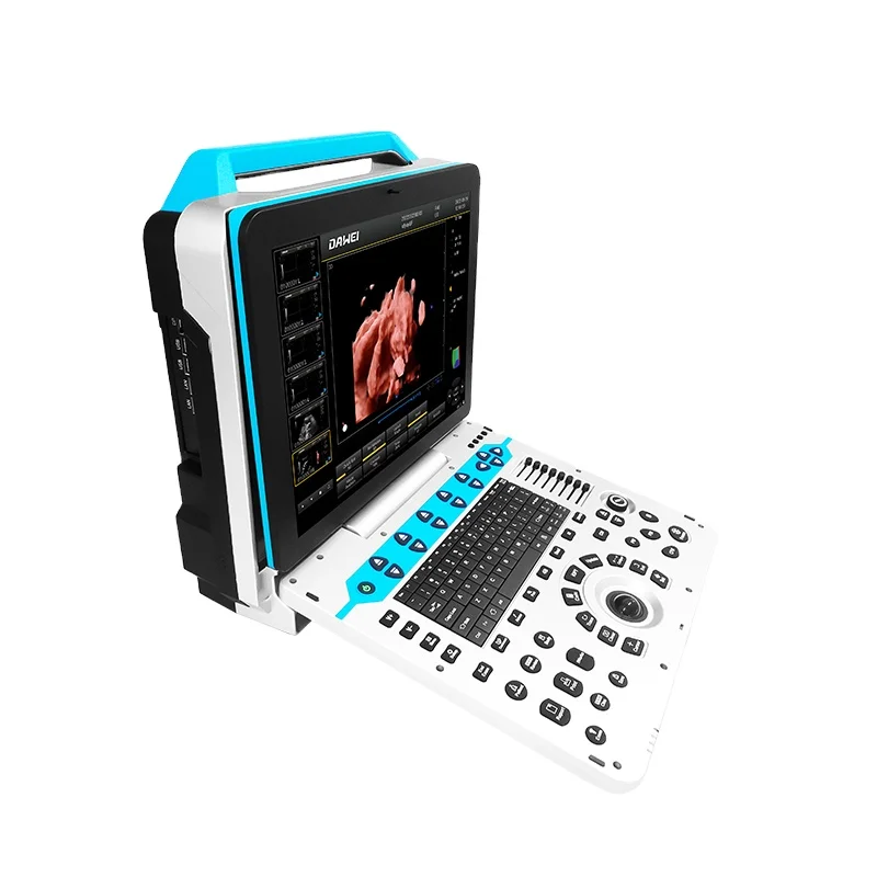 sales low price portable laptop 4D DLIVE color doppler ultrasound machine