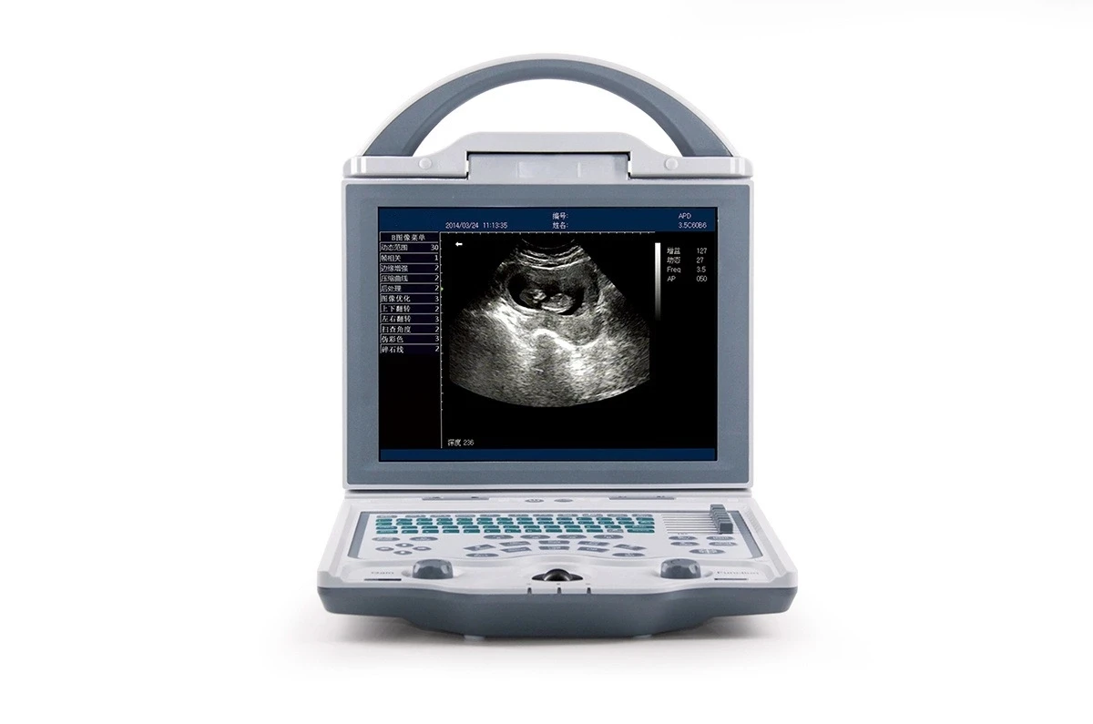 Dp-10 vet DP-10 Digital Ultrasonic Diagnostic Imaging System Ultrasound Scanner ecografo  dp10 ultrasonic power board