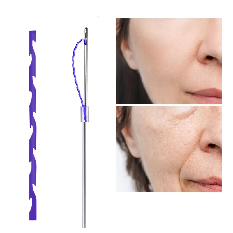 Korean fishbone molding pdo cog thread needle arm lifting CE approved press cog Z type whale shark molding pdo thread