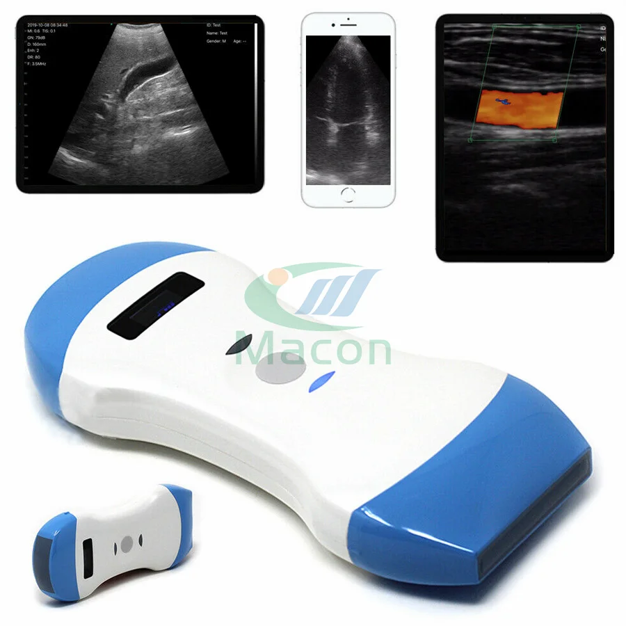 MC25 3 arrays 5 imaging modes 3 in 1 wireless ultrasound probe scanner for full body diagnostic imaging