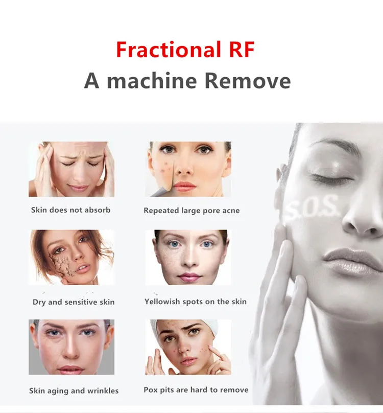 Fractional Rf Microneedle Machine/factory price of Rf Fractional machine