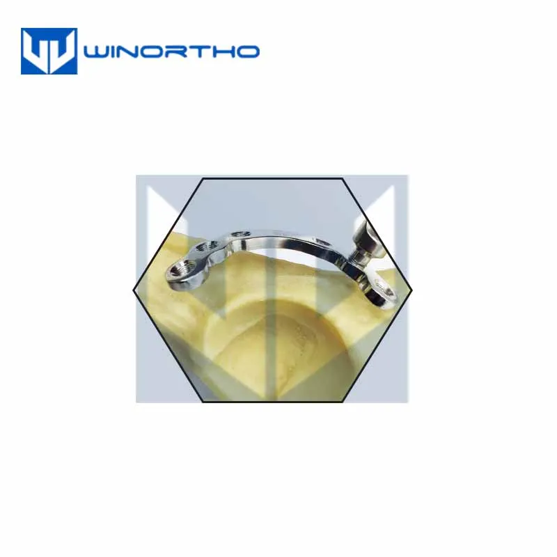 1.5mm Locking Acetabular plates screws vet veterinary orthopedic instruments surgical tools bone pet small animal