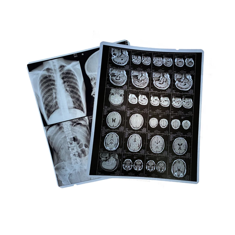 280mic waterproof digital printing blue x-ray inkjet medical film for radiology imaging