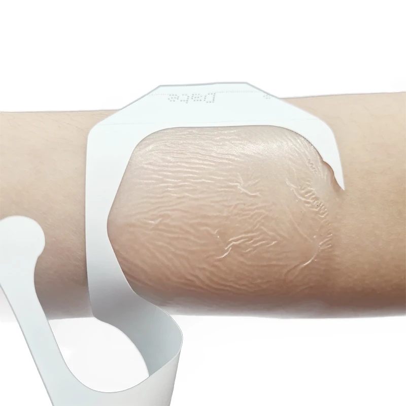 iv transparent wound dressings for wound care iv cannula dressing adult and children use transparent film dressing plaster