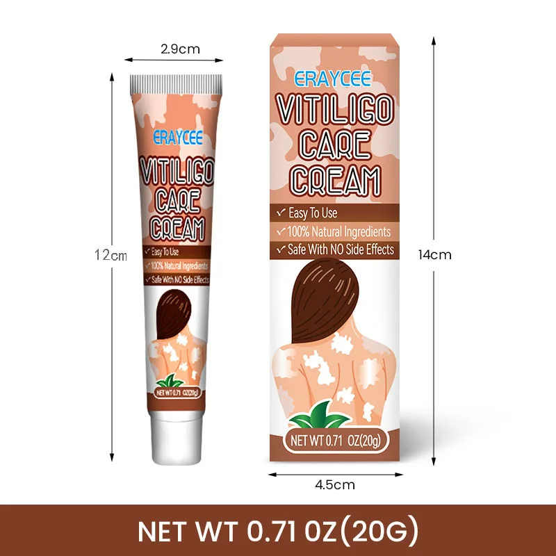Vitiligo Safe and Effective Treatment Cream White Spot Ointment Flower Spot Sweat Purpura Skin Topical Ointment