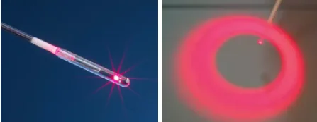 Surgery lipolysis face lift endolaser bare fiber evlt radial fiber hemorrhoid fistula fiber