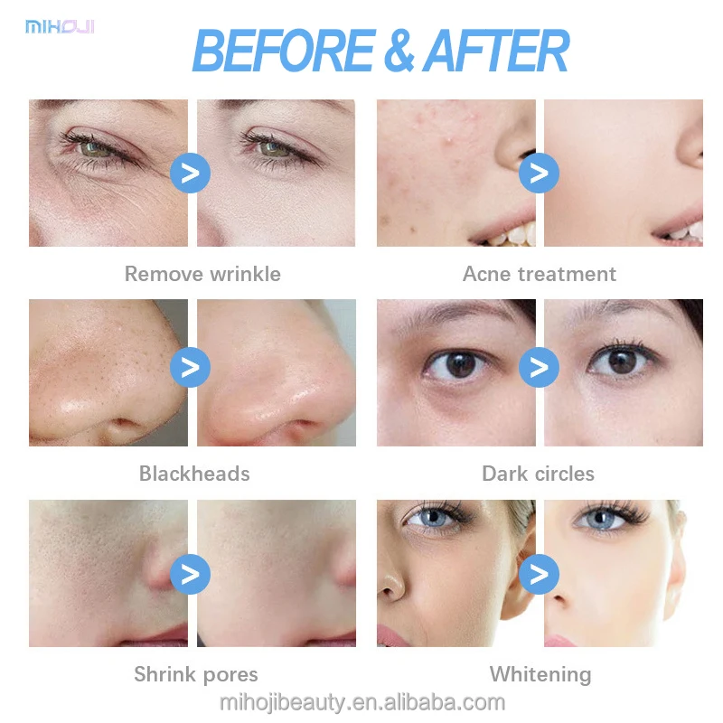 7 in 1 smart ice blue plus skin detection wet dermabrasion hydro facial machine