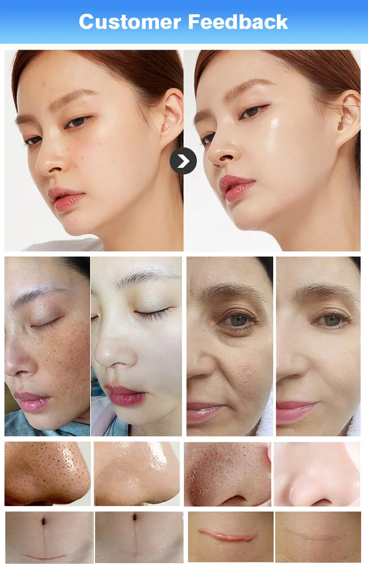 New Arrivals 15 In 1 Dermabrasion Facial H2O2 Small Bubble Skin Oxygen 2 Head Skin Scrubber Aesthetic Bubble Beauty Instrument