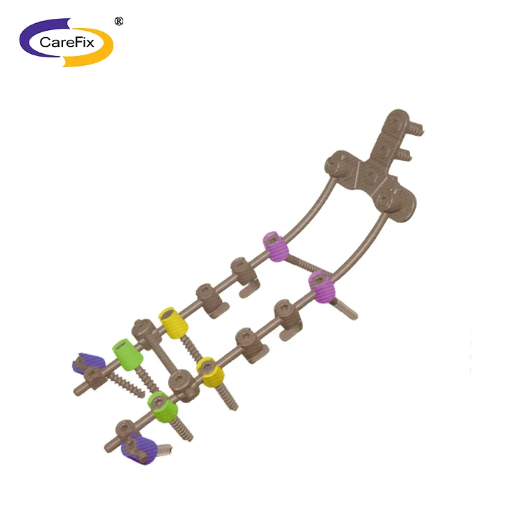 Титановые Ортопедические имплантаты для позвоночника