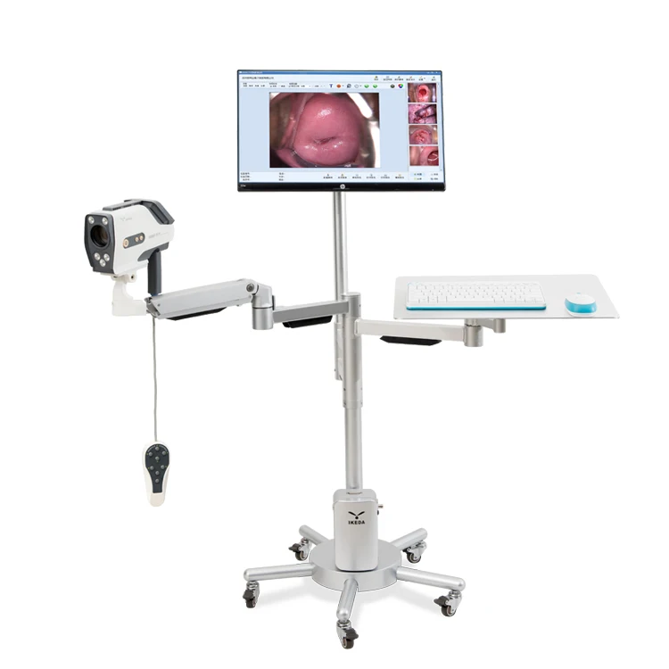 Full HD Colposcope Camera for Vagina Colposcopy