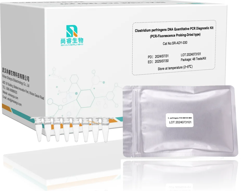 Clostridium perfringens DNA Quantitative PCR Diagnostic Kit (PCR-Fluorescence Probing-Dried type)