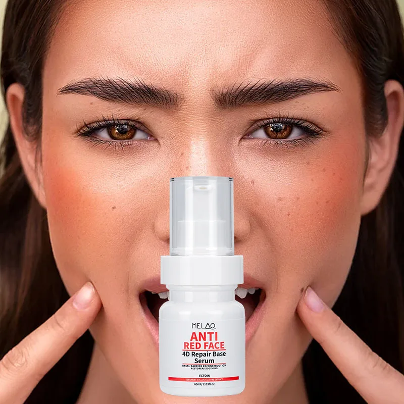 Custom Logo Sensitive Skin Hydrating Face Serum Calming Redness Relief Face Serum Deep Repairing Red Face Serum