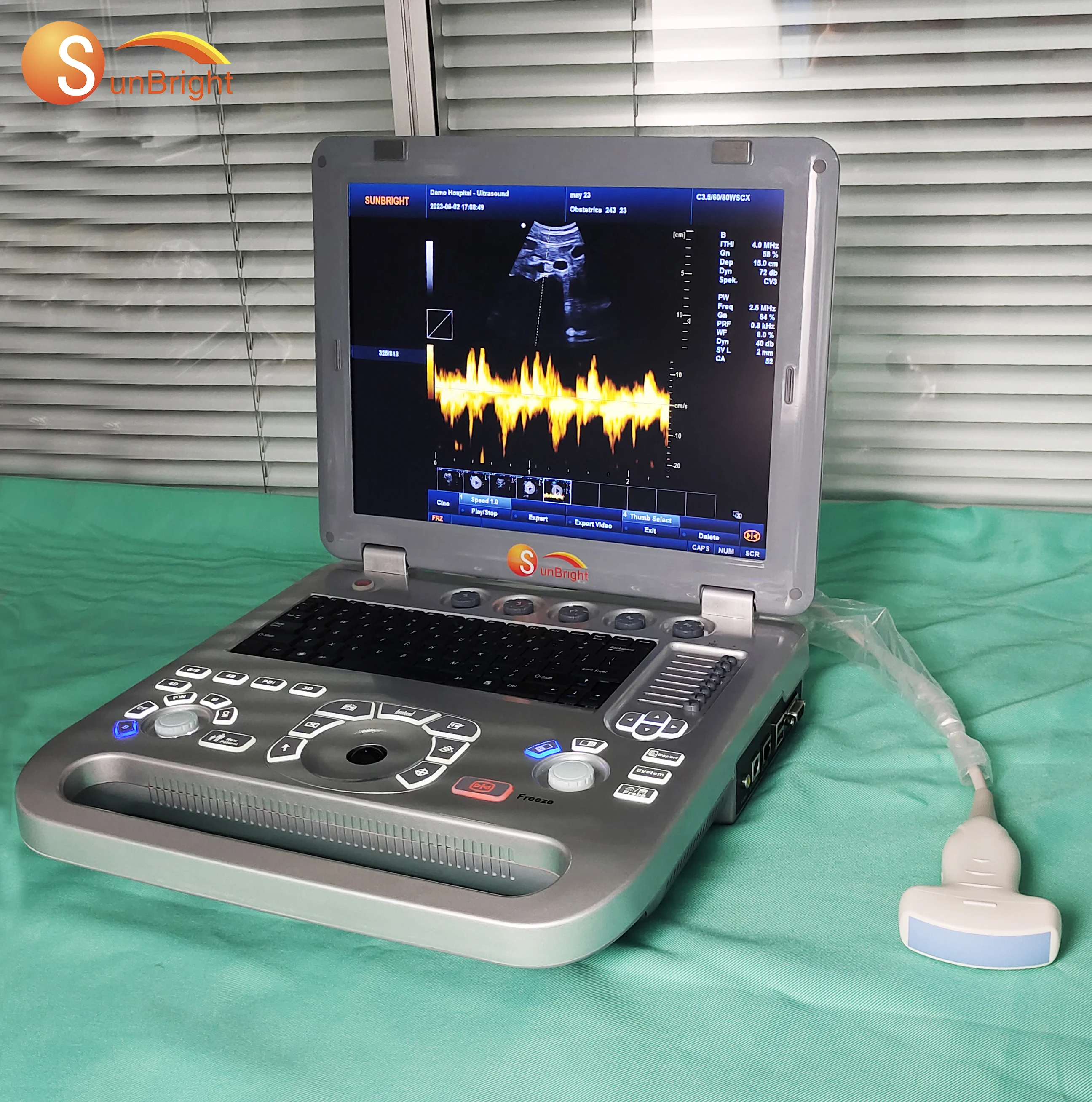 2024 ultrasound scanner 3D pregnancy ultrasonic PW portatil ultrasound model