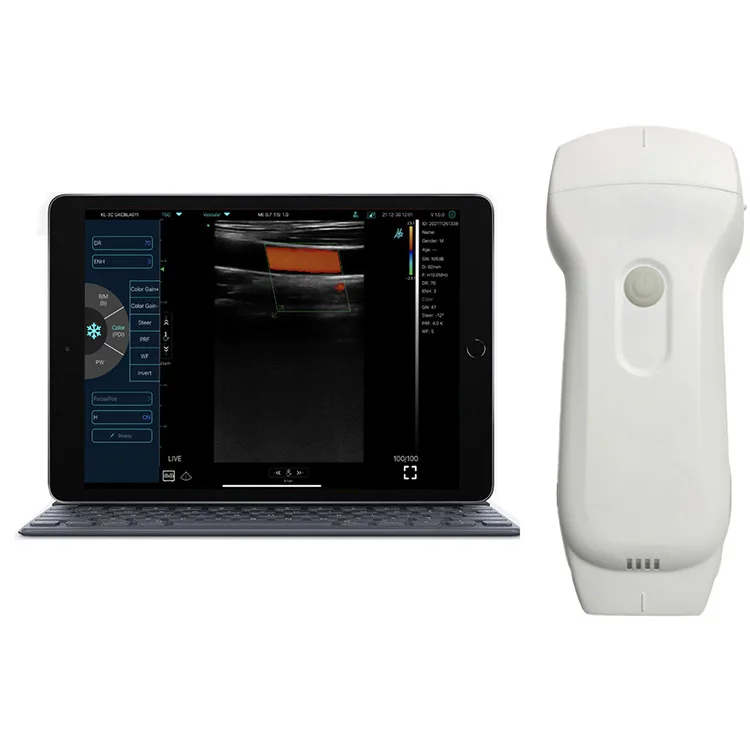 Professional Medical Devices C10RL Ultrasound Vein Illumination System, Infrared Viewer / Portable FinderClinical Analytical In