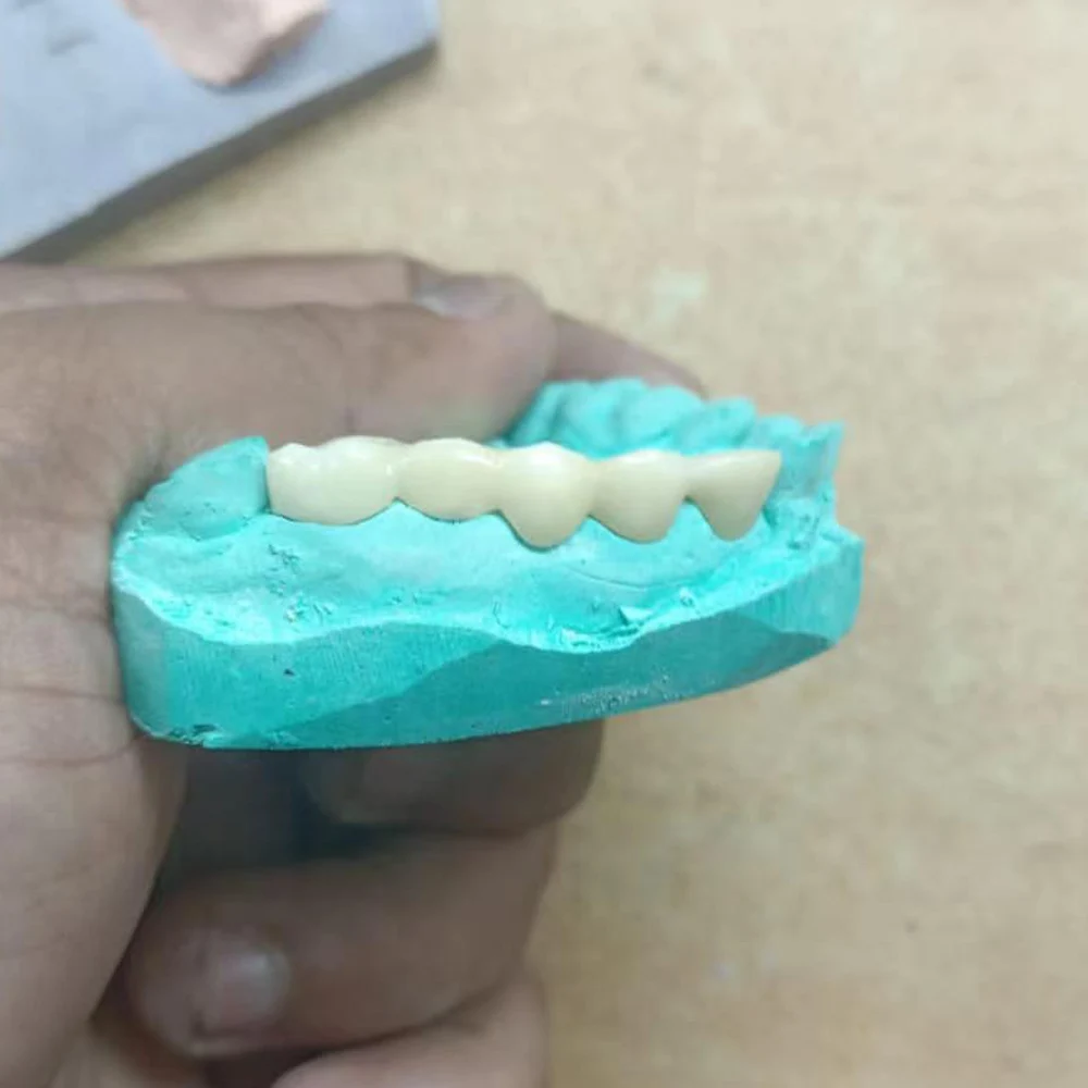 Zahndent 98 95 92mm zirconia block HT zirconia disc cad cam dental lab ceramic disc