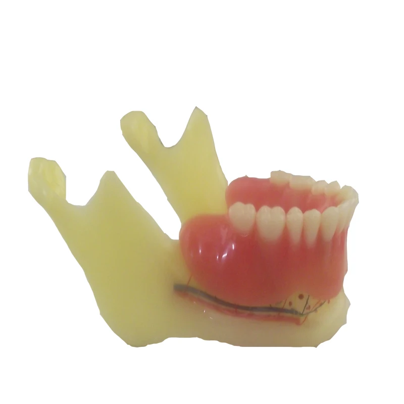 Resin Mandibular Detachable Jaw Bone Denture Model with Belt Nerve and Teeth