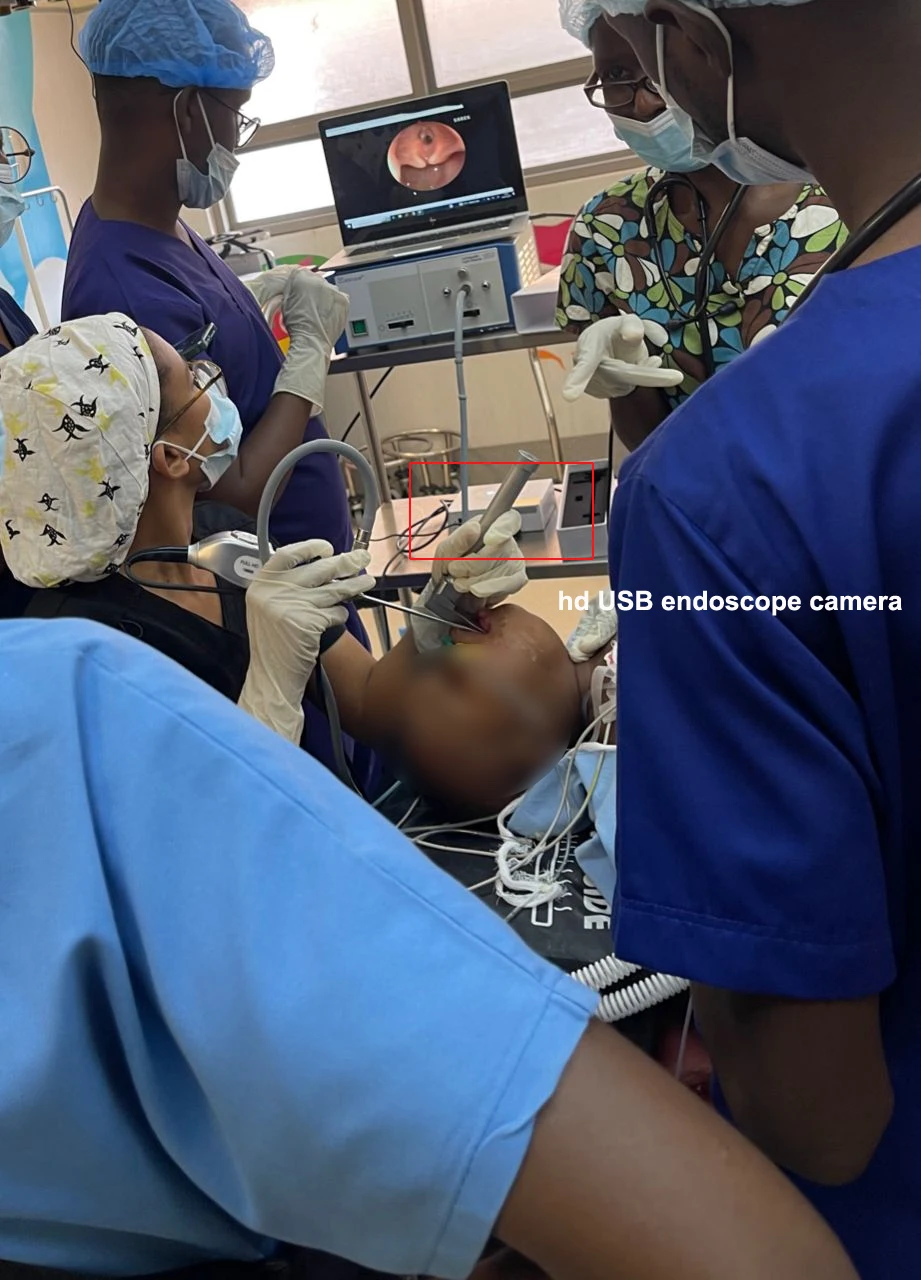 medical hd usb endoscope camera usb video laryngoscopy system