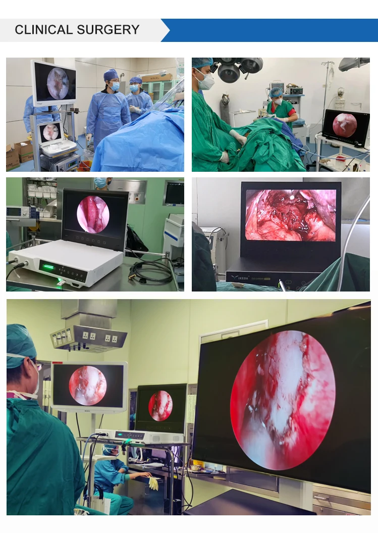 Full HD Endoscope Camera Orthopedic Endoscopy with 19inch HD monitor