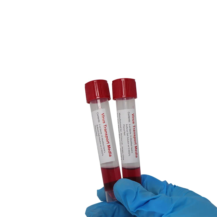 Hot Sale Disposable Virus Sample Tube 5 ml Vtm Sampling Kit With Nasal Throat Swab Vtm Test Kit