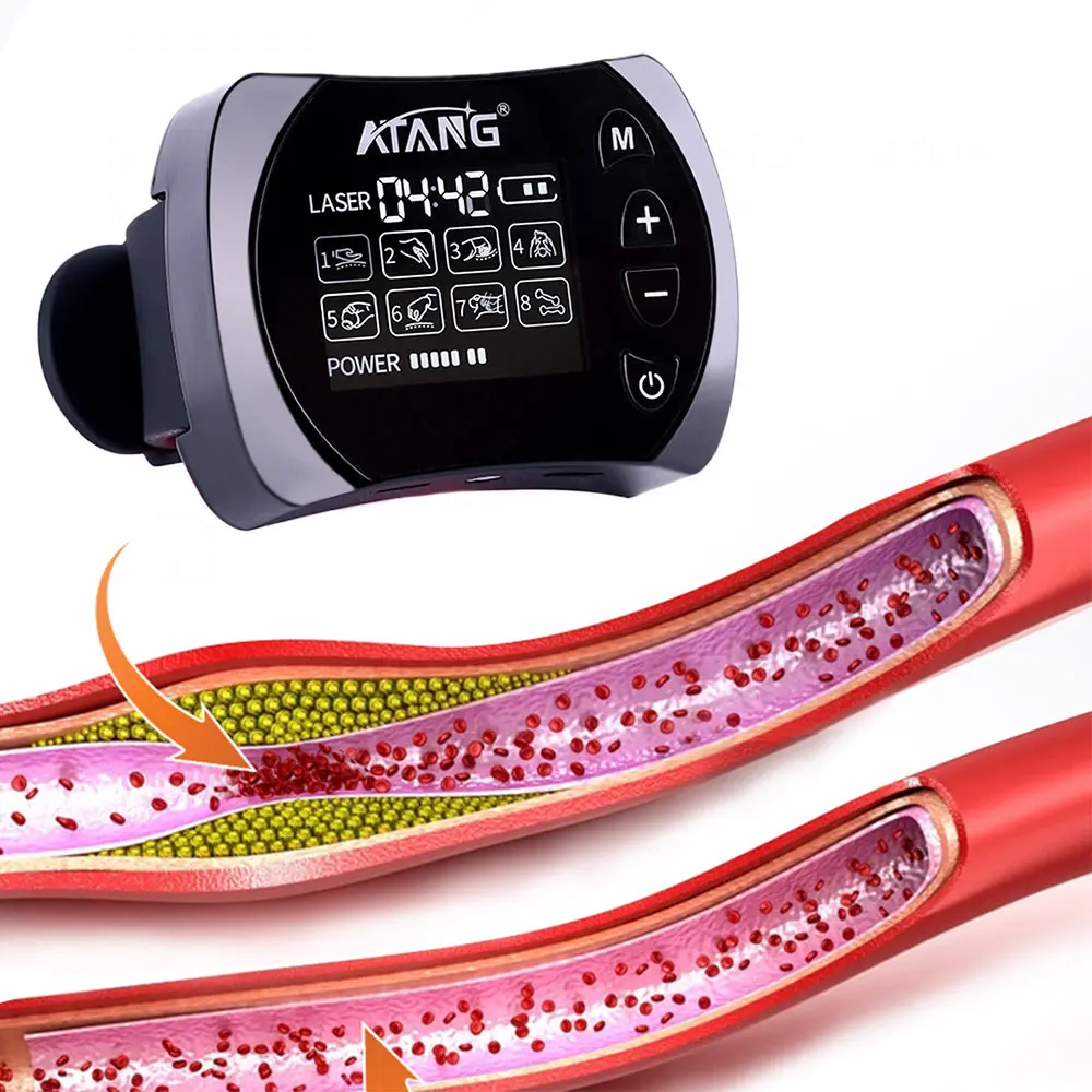 ATang Diabetes watch 650 nm LLLT Cold Laser Medical Devices Blood Glucose Balance Watch with EMS Laser Therapy Watch