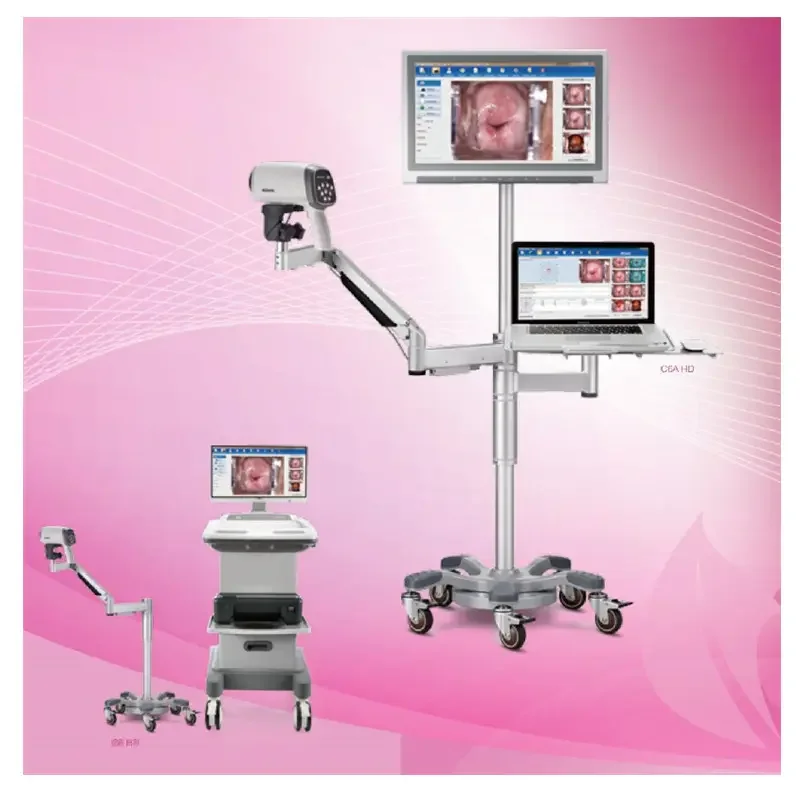 EDAN C6HD оригинальный HD видео кольпоскоп производители