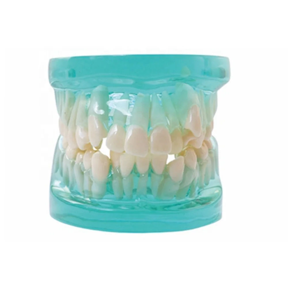 Зубная Ортодонтическая модель исследования без кронштейна 28 зубов