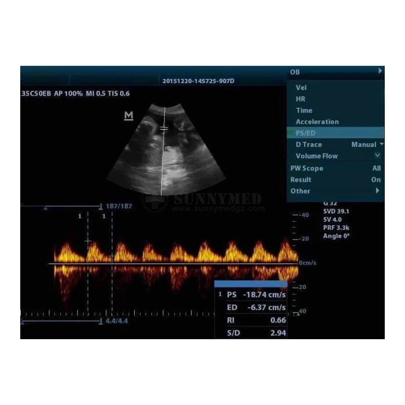 Medical Ultrasound Instrument DP20  2D Color Doppler Ultrasound Human Use Digital Mindray BW Ultrasound DP-20