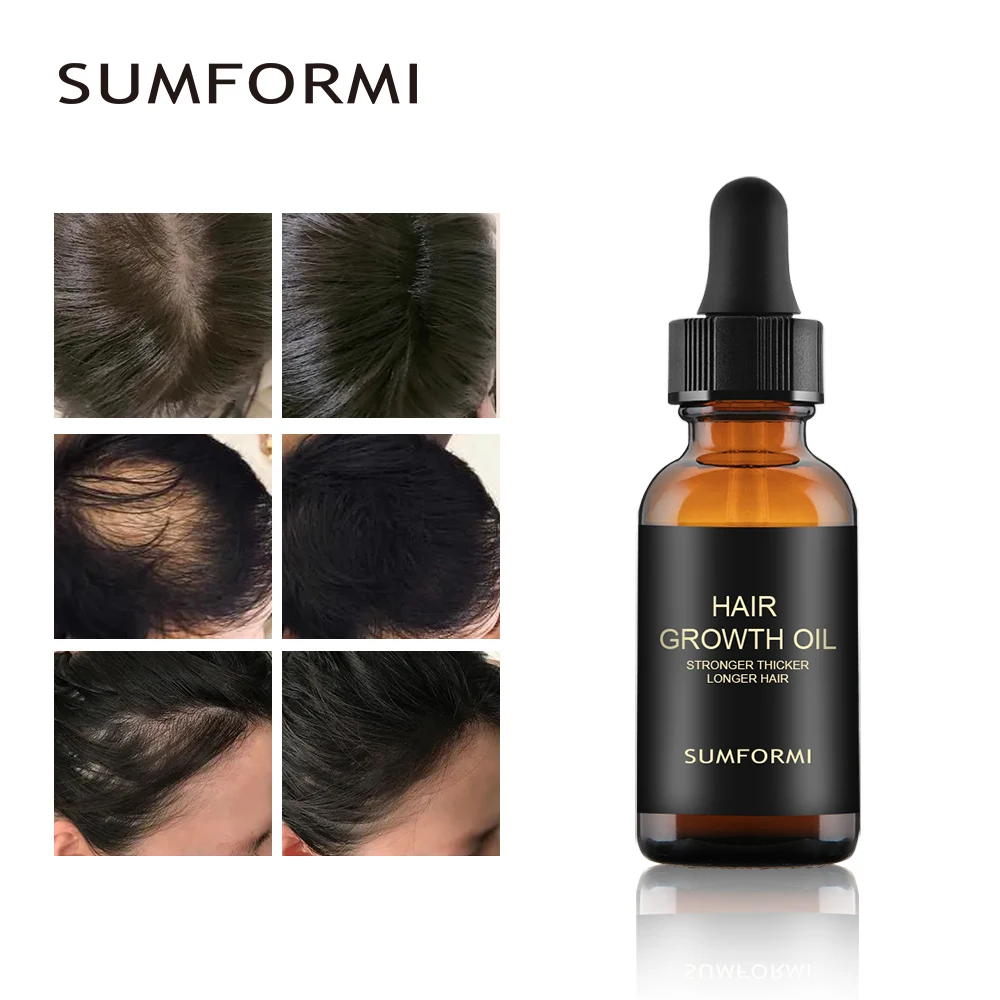 Wholesale Natural Organic Essential Oil For Hair Growth Smooth  Moisturizing Anti Dry Treatment Hair Essential Oil For Women