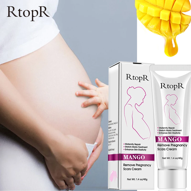 RtopR Amazon Hot Sale Best Natural Organic Mango Anti Vergeture Repair Scar Stretch Mark Removal Cream
