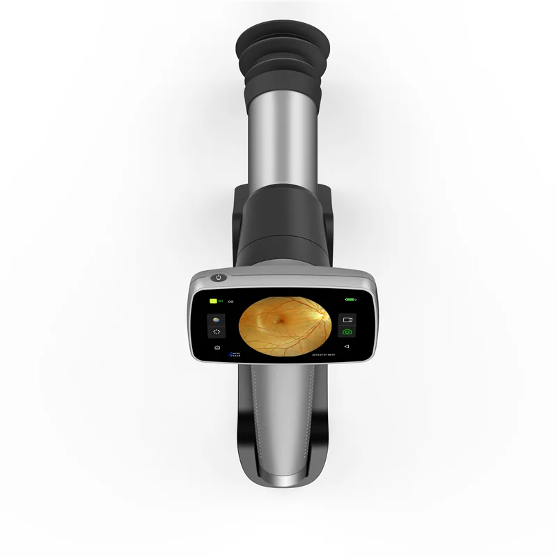 Hand-held Fundus Camera Digital Wifi Ophthalmoscope For Eye Fundus Inspection With 3.97 Inch Touch Screen
