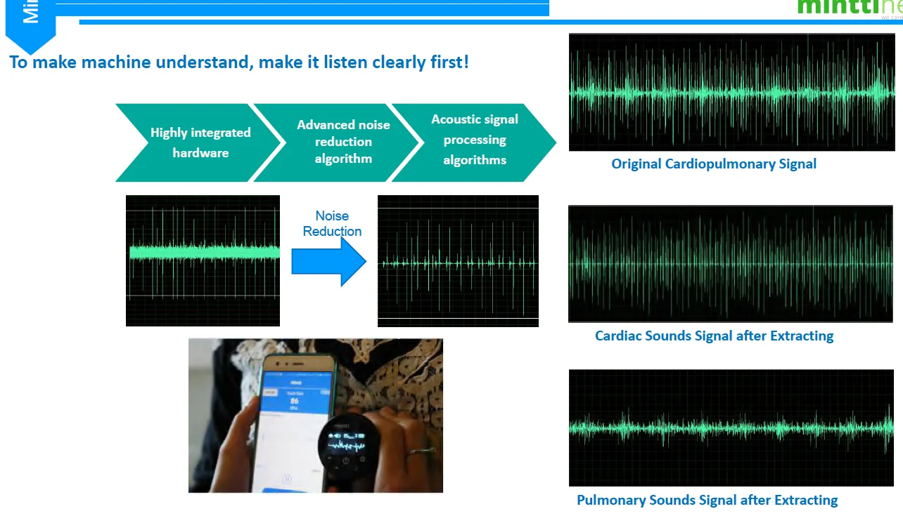 Doctor professional non contact digital stethoscope electronic stethoscope for Telemedicine