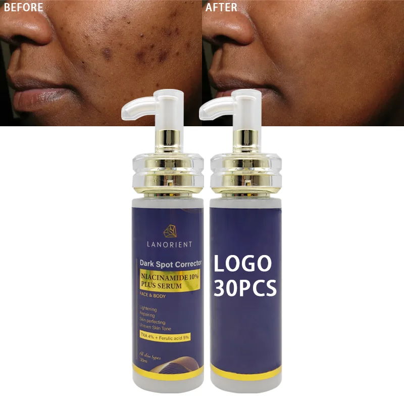 Private Label Natural Organic Vegan 10% Nicotinamide Skin Brightening Pigment Correction Facial Serum For All Skin Types