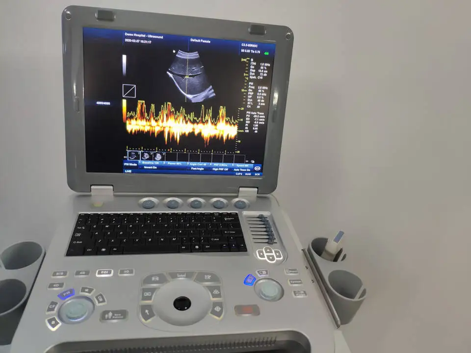 JM-906B laptop ultrasonic machine cheap 3D 4D Color Doppler scanner with battery