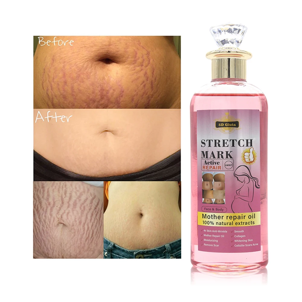 Organic 100% Natural Extracts Stretch Marks Oil Private Label Postpartum Repair Firming Face Body Stretch Mark Remover Oil