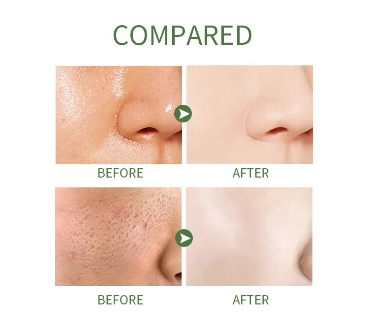 Wholesale OEM OBM natural Anti Acne Egg Plant Clay Green Mask Stick Pore Cleanser poreless deep cleansing mask stick mask 40g