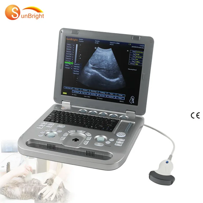 Cheapest Medical 3D Laptop 15 inch vet Ultrasound Scanner
