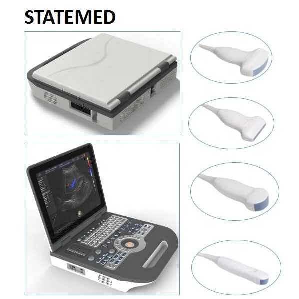 15 Inch portable digital ultrasound diagnostic system 128 element ultrasound with convex probe