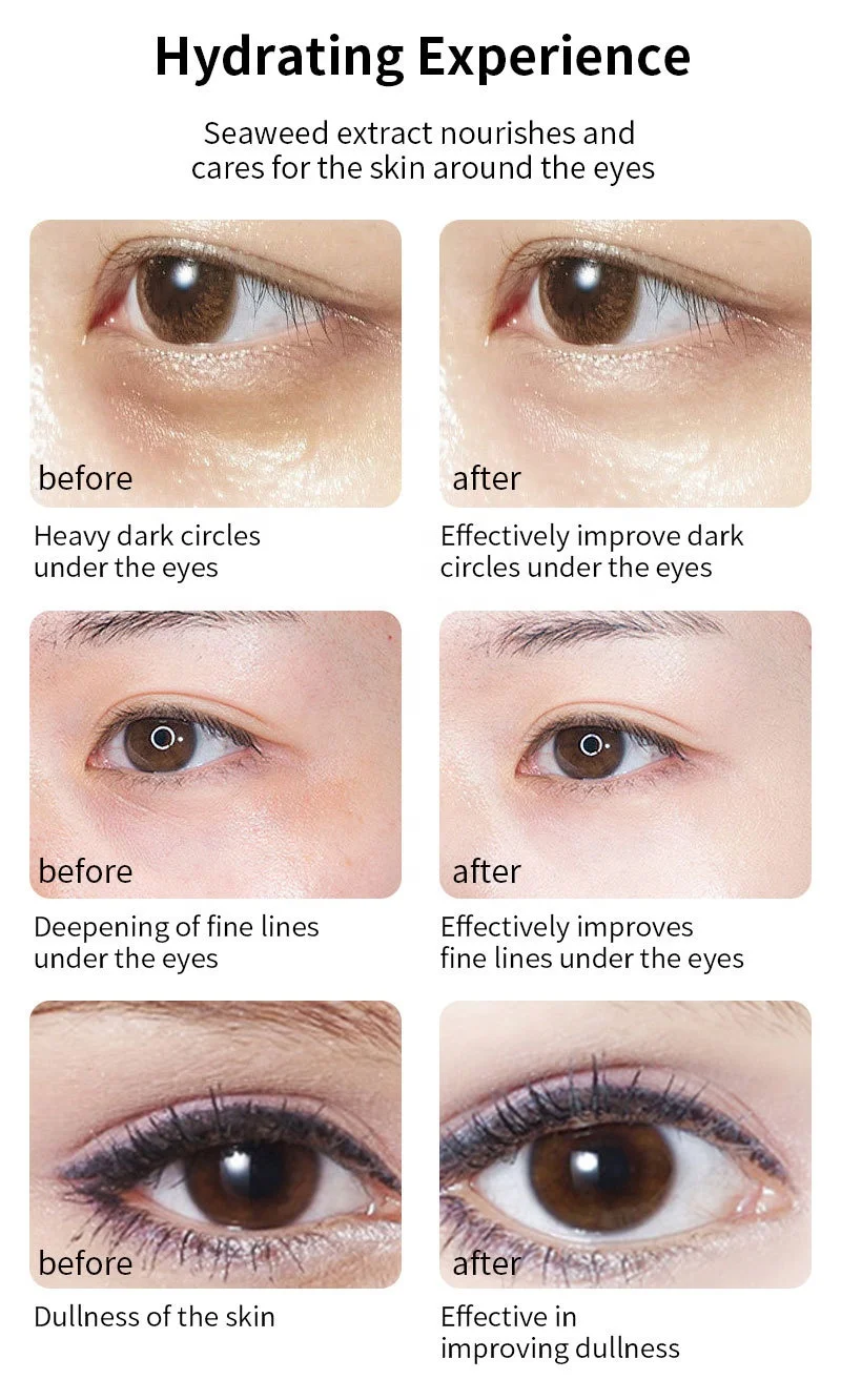 OEM factory wholesale 6 pairs organic eye mask patch dark circles eye bags marine collagen eye gels