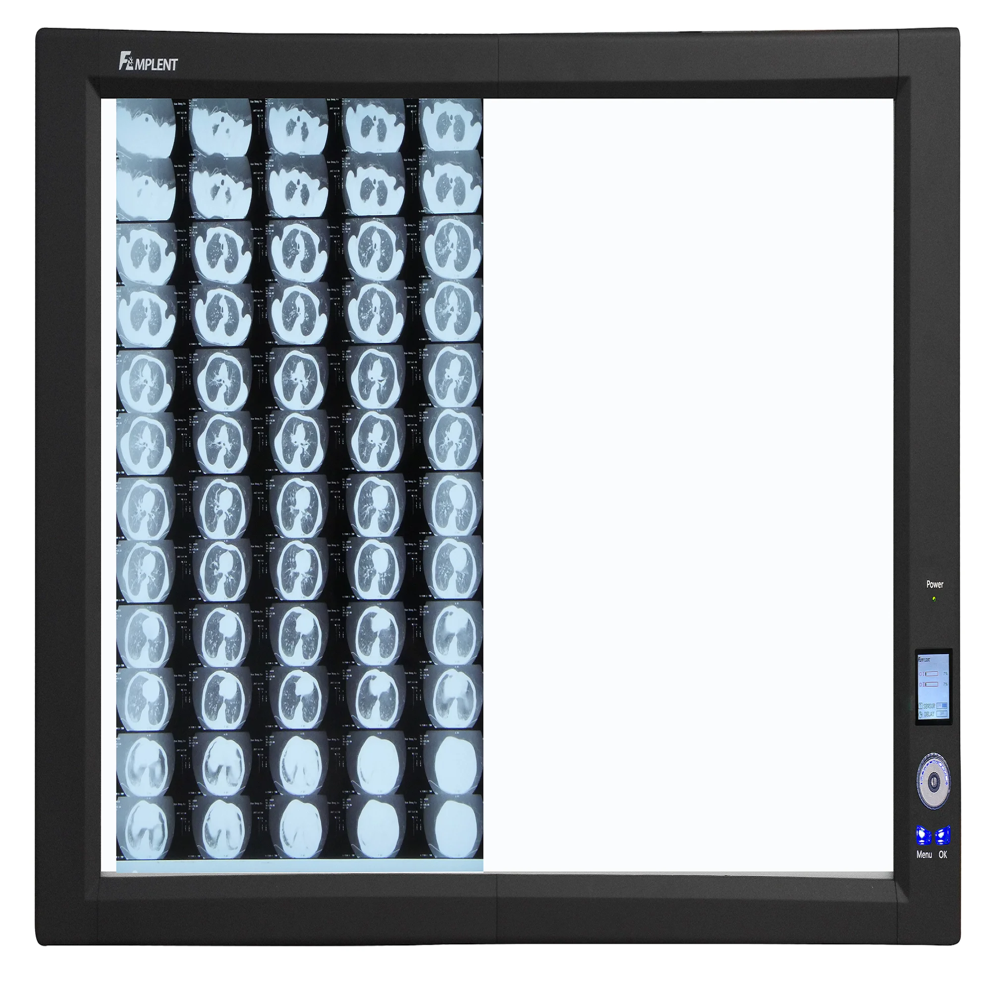 Ysenmed YSX-GPD Ultra High Brightness LED X Ray Film Viewer