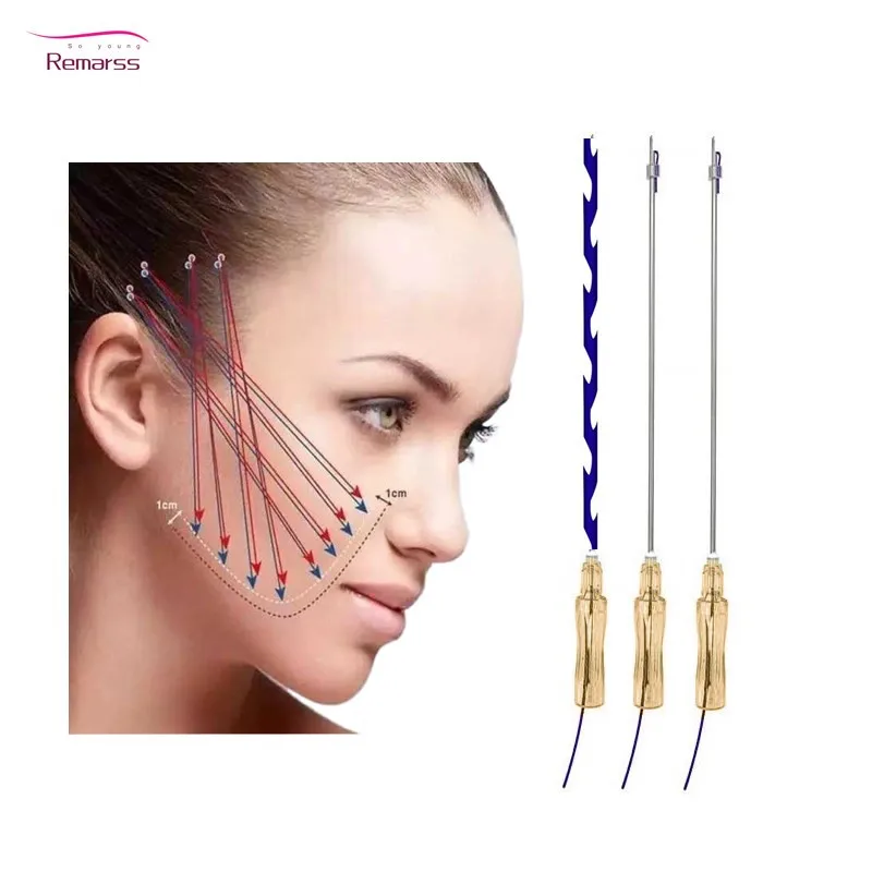 pcl thread mono 30g25mm for under eye wrinkles eye bag treatment