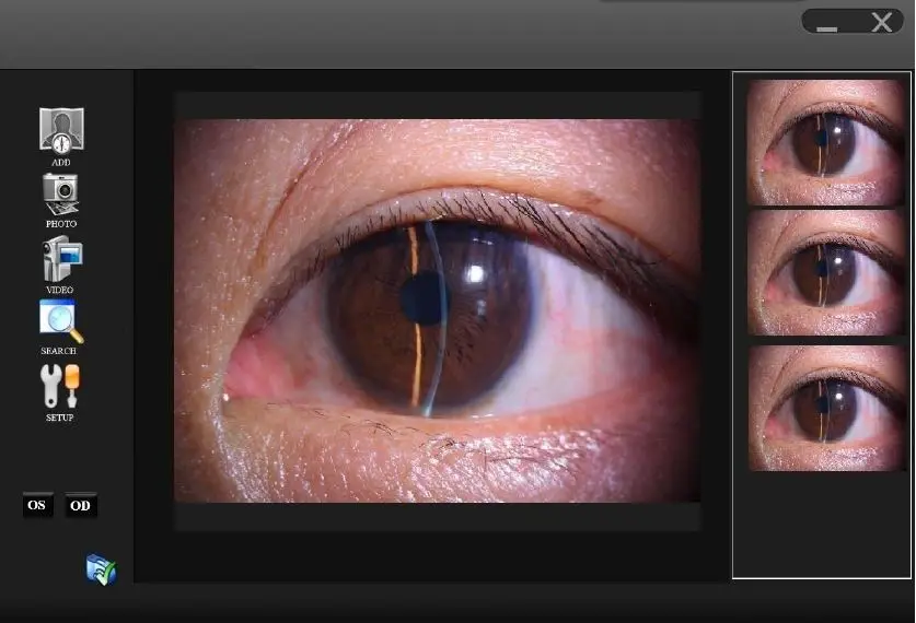 Hot Sale YZ5J Slit Lamp Microscope