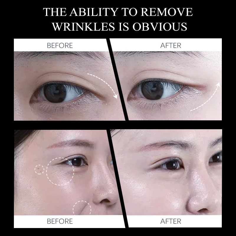 Korean organic private label stem cell lift eye creams anti aging wrinkle snail removal best under dark circle eye cream